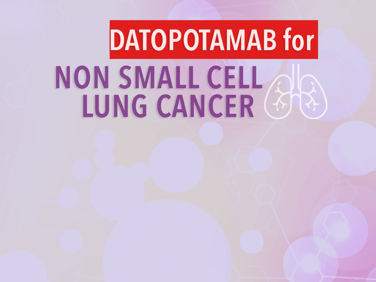 Datopotamab Treatment for Non-Small Cell Lung Cancer - CancerConnect