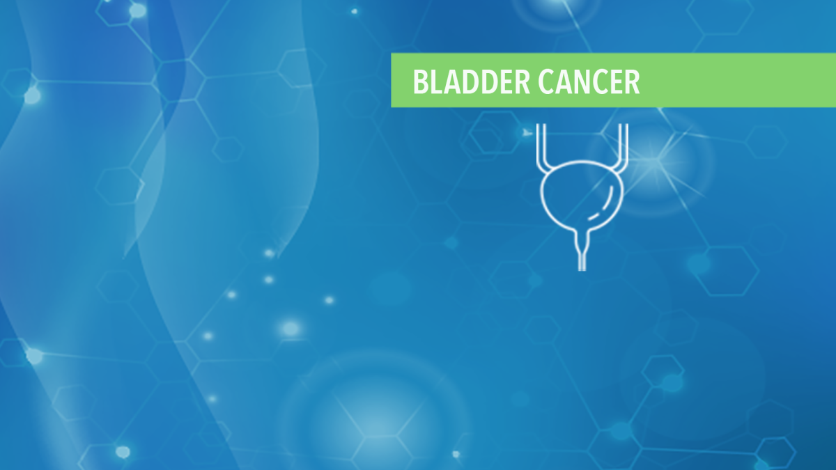 stage 2 bladder cancer treatment