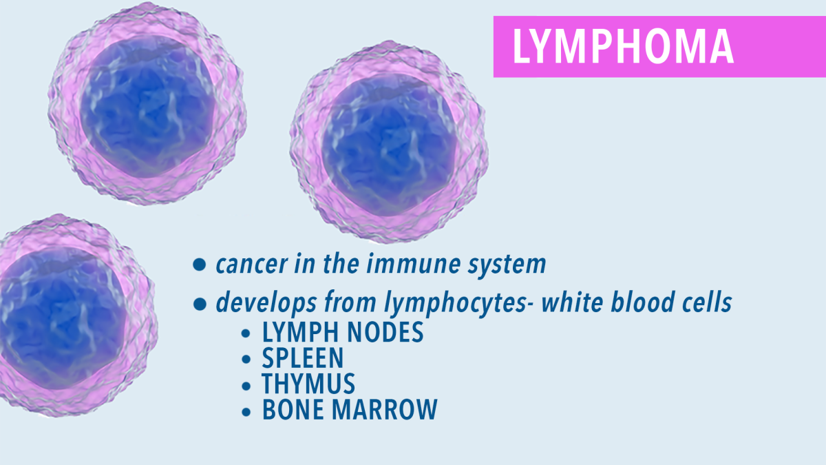 Lymphoma Classifications CancerConnect