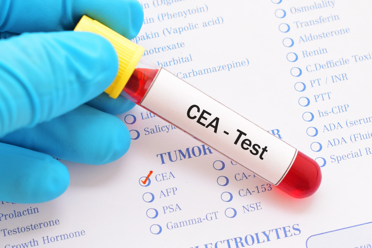 Comparison of tumor marker levels between the two groups before and