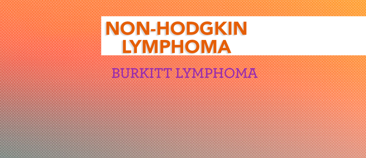 Treatment of Burkitt Lymphoma