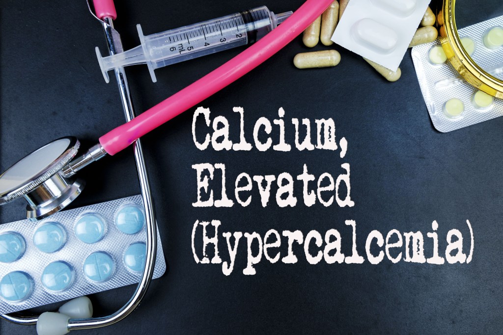 Overview of Hypercalcemia